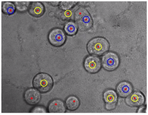 Picture for Quantification of Penetration of Cancer Cells on a Gel Surface