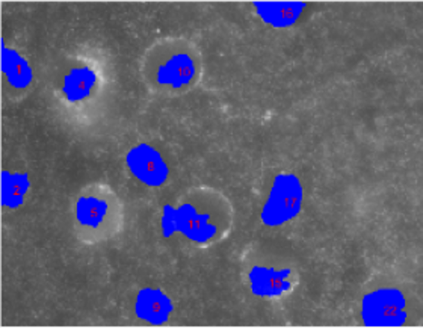 Picture for Quantification of penetration of Cancer on a Gel surface